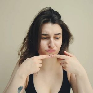 Acne and Hormonal Imbalances: How Your Diet Can Help Regulate Hormones