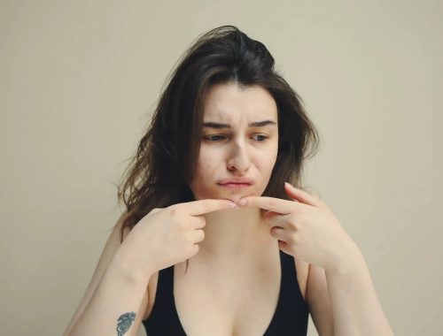 Acne and Hormonal Imbalances: How Your Diet Can Help Regulate Hormones