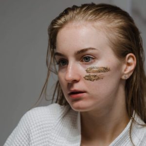 Most Effective Topical Treatments for Melasma