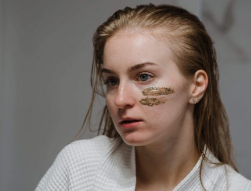 Most Effective Topical Treatments for Melasma