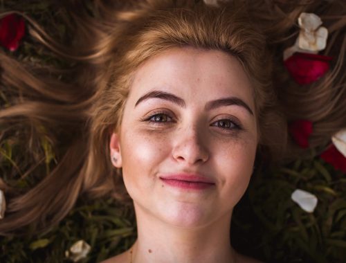 Different Types of Melasma and How to Identify Them